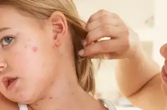 Жительница вернулась из Турции с клиническими симптомами